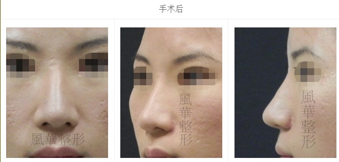 治疗后,蒜头比治疗治疗前后对比图